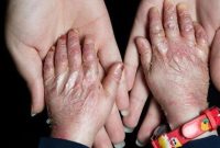 آمریکا در پرونده “تحریم کودکان پروانهای” محکوم شد آمریکا در پرونده “تحریم کودکان پروانهای” محکوم شد